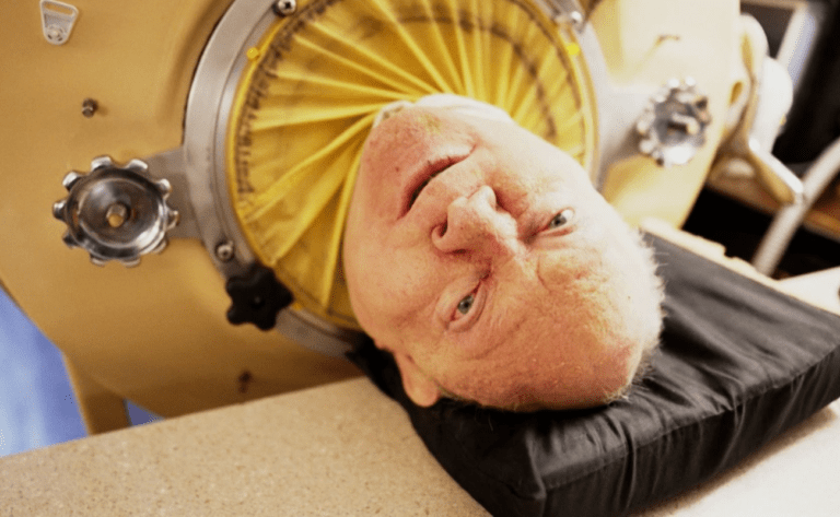 Paul Alexander, who breathed with iron lungs, lived happily as long as he lived.